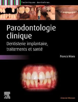 Parodontologie clinique: Dentisterie implantaire, traitements et santé by Francis Mora