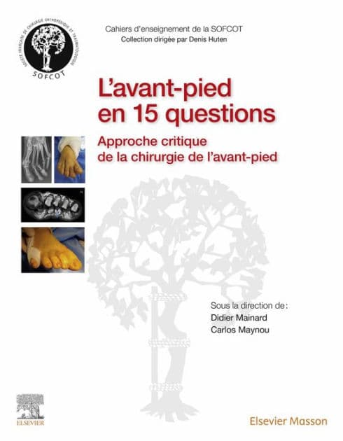 L'avant-pied en 15 questions: Approche critique de la chirurgie de l'avant-pied by Didier Mainard