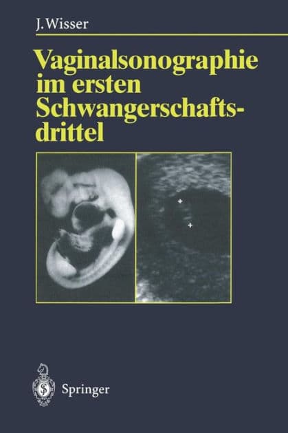 Vaginalsonographie im ersten Schwangerschaftsdrittel by Josef Wisser