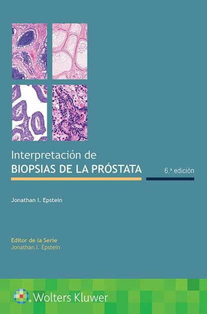 Interpretación de biopsias de la próstata by Jonathan I. Epstein MD