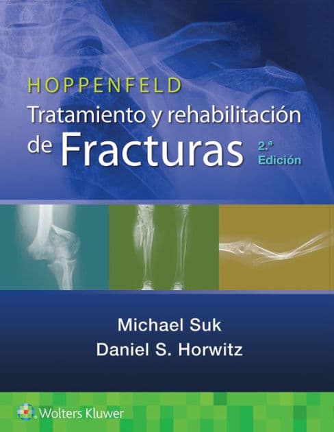 Hoppenfeld. Tratamiento y rehabilitación de fracturas by Michael Suk MD