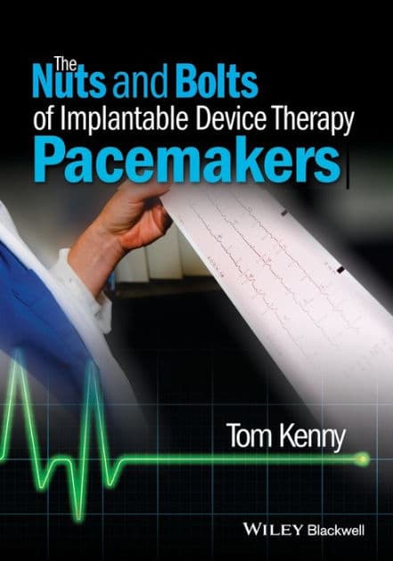 The Nuts and Bolts of Implantable Device Therapy: Pacemakers by Tom Kenny