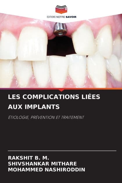 Les Complications Liï¿½es Aux Implants by Rakshit B M