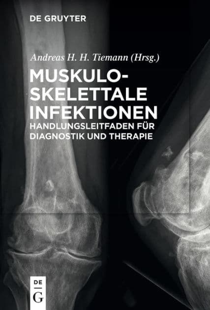 Muskuloskelettale Infektionen: Handlungsleitfaden für Diagnostik und Therapie by Andreas Heinrich Tiemann