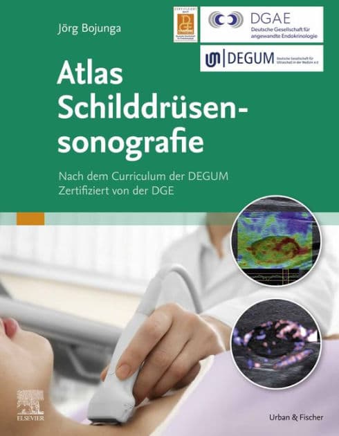 Atlas Schilddrüsensonografie by Jörg Bojunga