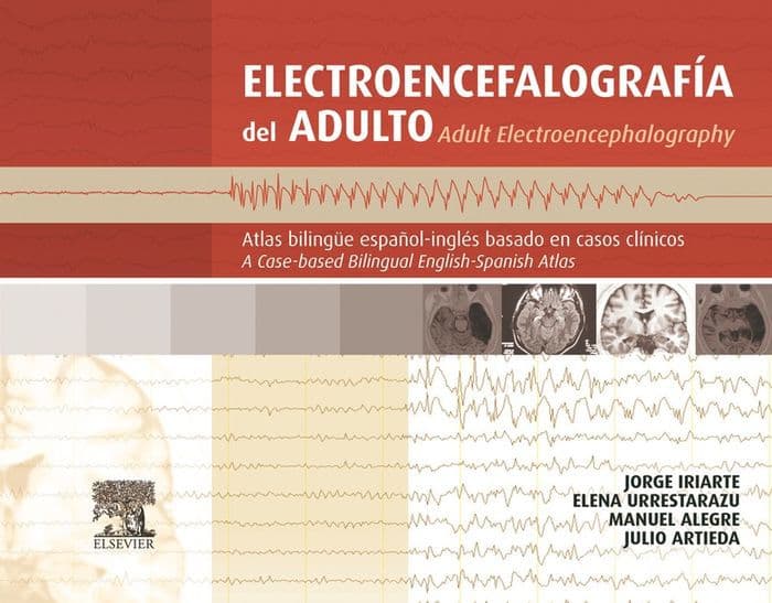 Electroencefalografía del adulto: Atlas bilingüe español-inglés basado en casos clínicos by Jorge Iriarte Franco