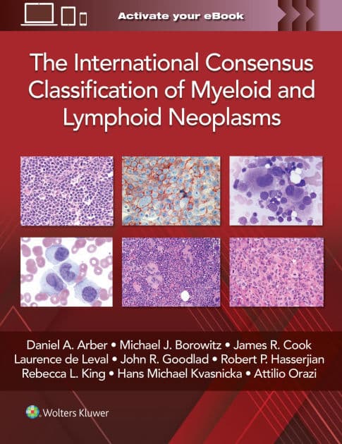 The International Consensus Classification of Myeloid and Lymphoid Neoplasms by DANIEL A. ARBER
