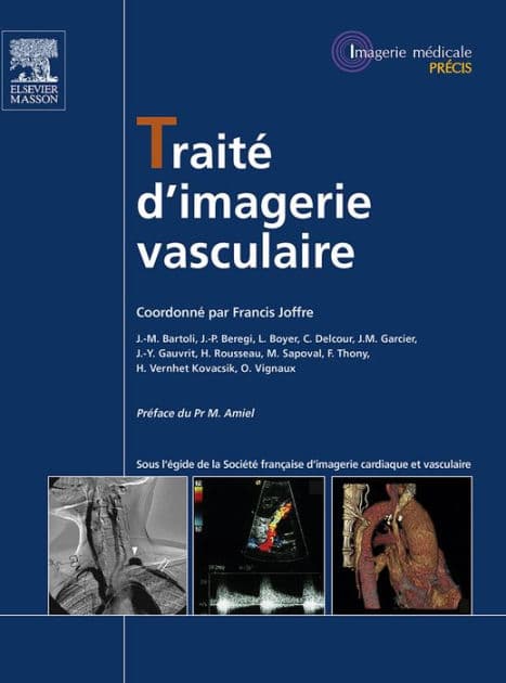Traité d'imagerie vasculaire by Francis Joffre