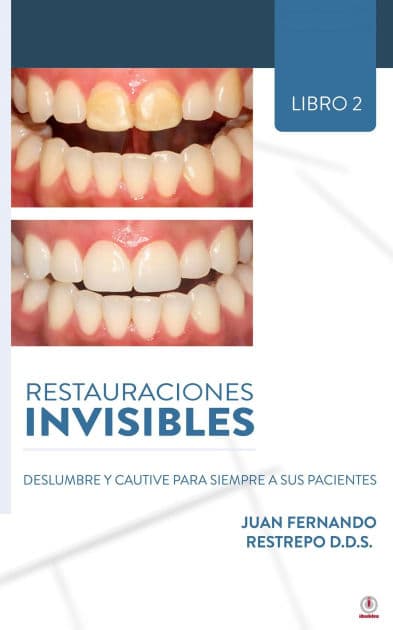 Restauraciones Invisibles: Deslumbre Y Cautive Para Siempre A Sus Pacientes by Juan Fernando Restrepo