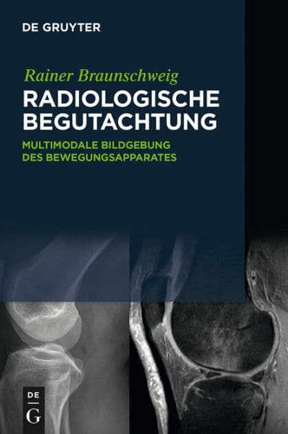 Radiologische Begutachtung: Multimodale Bildgebung des Bewegungsapparates by Rainer Braunschweig