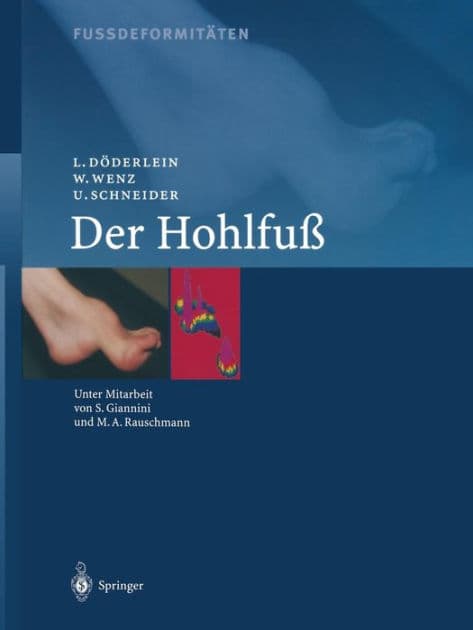 Fussdeformitï¿½ten: Der Hohlfuss by L. Dïderlein