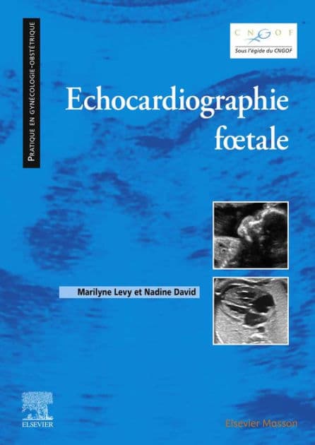Echocardiographie fotale by Maryline Lévy