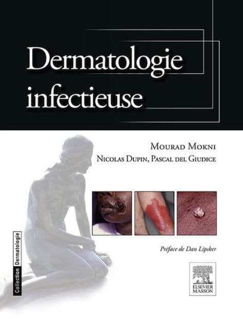 Dermatologie infectieuse by Mourad Mokni