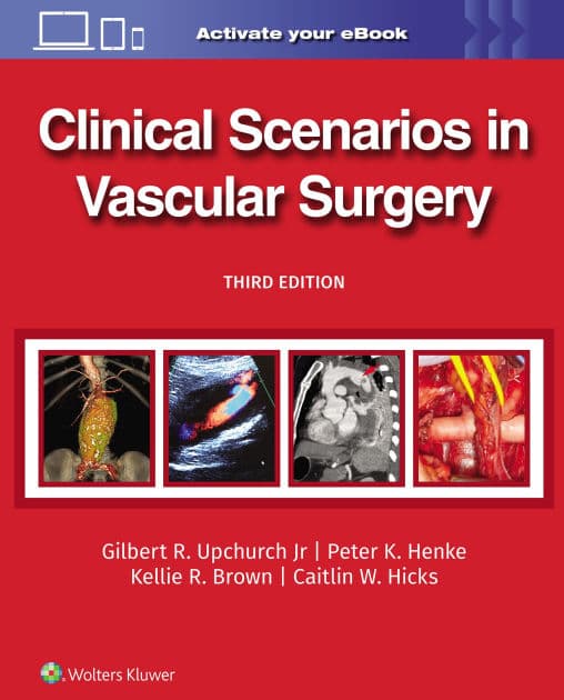 Clinical Scenarios in Vascular Surgery by GILBERT R. UPCHURCH JR