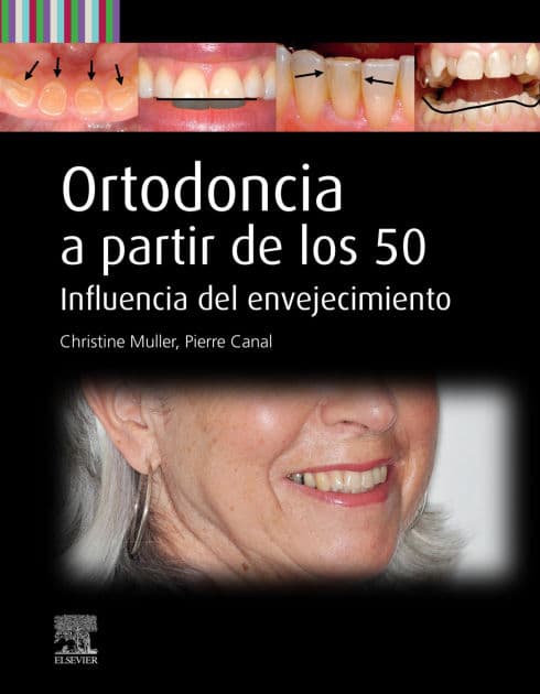 Ortodoncia a partir de los 50: Influencia del envejecimiento by Christine Muller