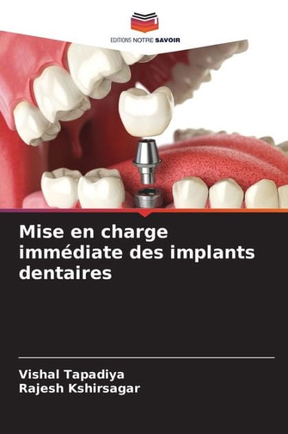 Mise en charge immï¿½diate des implants dentaires