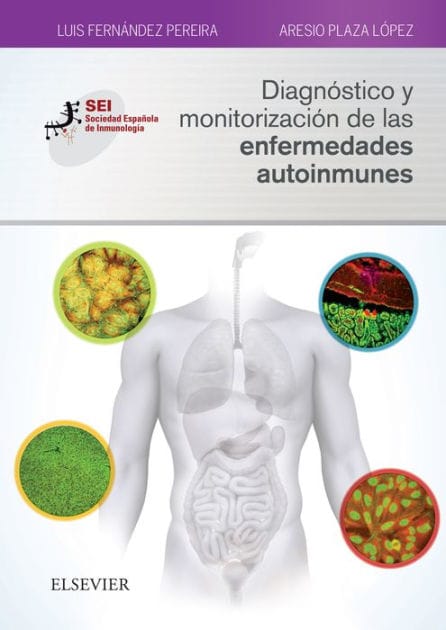 Diagnóstico y monitorización de las enfermedades autoinmunes: Sociedad Española de Inmunología