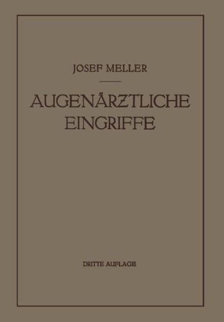 Augenärztliche Eingriffe: Ein Kurzes Handbuch für Angehende Augenärzte
