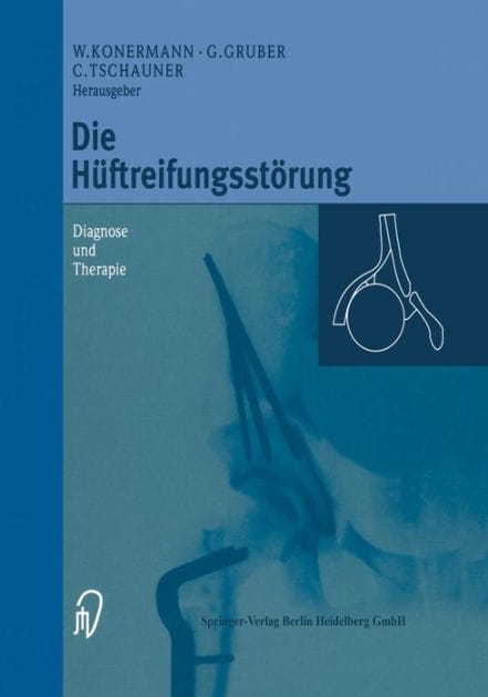 Die Hï¿½ftreifungsstï¿½rung: Diagnose und Therapie