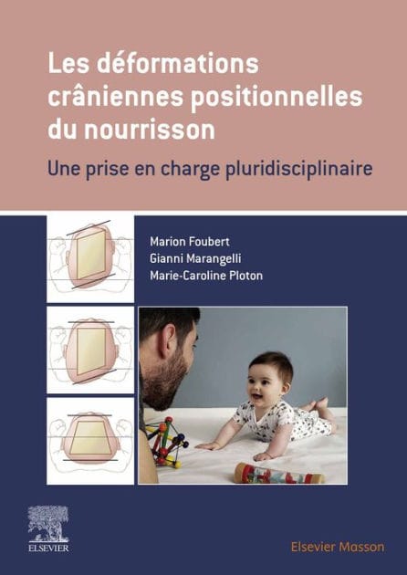 Les déformations crâniennes positionnelles du nourrisson: Une prise en charge pluridisciplinaire