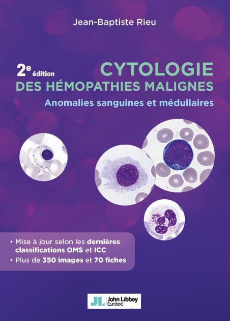 Cytologie des hémopathies malignes (2e édition): Anomalies sanguines et médullaires