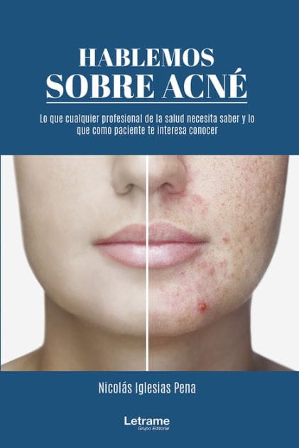 Hablemos sobre acné: 01 (Manual)