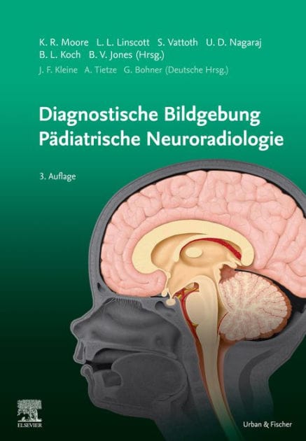 Diagnostic Imaging: Pädiatrische Neuroradiologie: Diagnostic Imaging: Pädiatrische Neuroradiologie