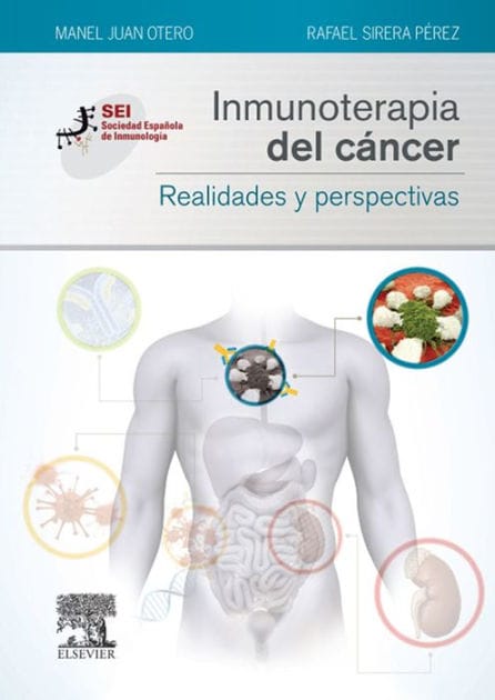 Inmunoterapia del cáncer. Realidades y perspectivas: Sociedad Española de Inmunología