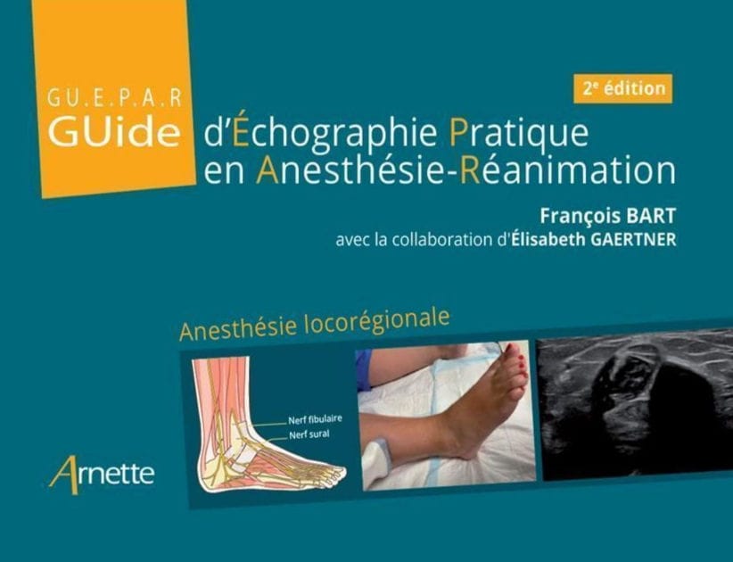 Guide d'Échographie Pratique en Anesthésie-Réanimation - GUEPAR (2e édition): Anesthésie locorégionale