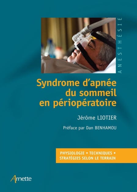 Syndrome d'apnée du sommeil en périopératoire: Physiologie Techniques Stratégies selon le terrain