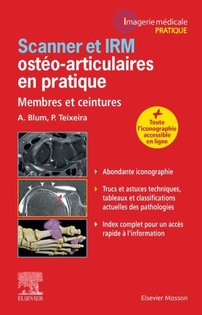 Scanner et IRM ostéo-articulaires en pratique: Membres et ceintures