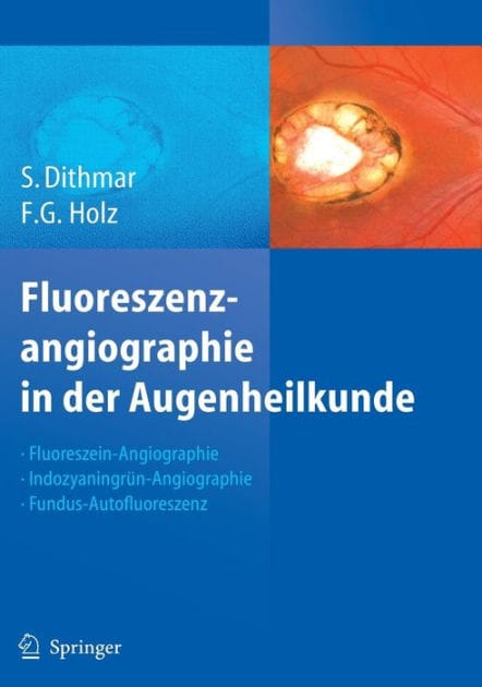 Fluoreszenzangiographie in der Augenheilkunde: Fluoreszein-Angiographie, Indozyaningrün-Angiographie und Fundus-Autofluoreszenz