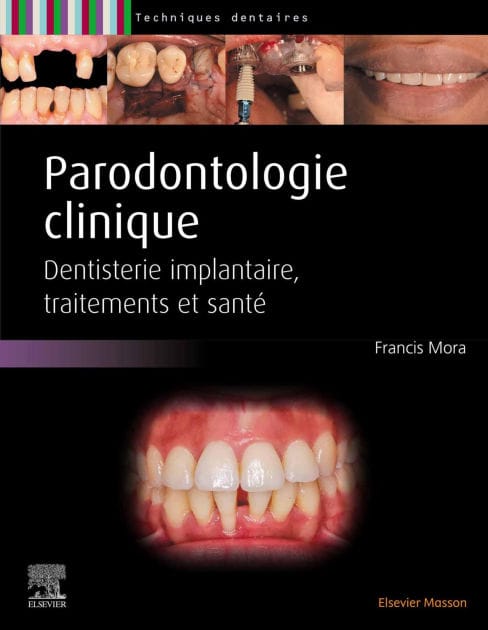 Parodontologie clinique: Dentisterie implantaire, traitements et santé