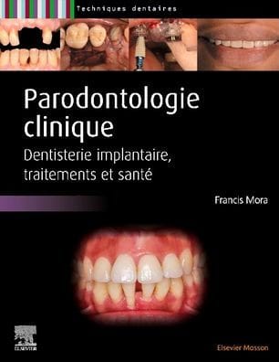 Parodontologie clinique: Dentisterie implantaire, traitements et santé
