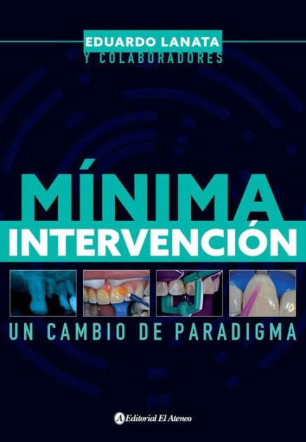 Mínima intervención: Un cambio de paradigma