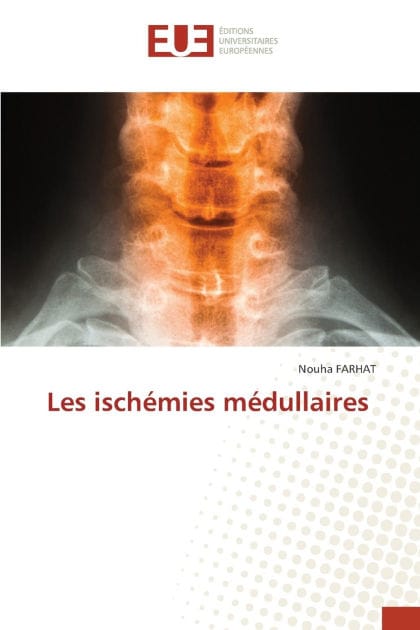 Les isch�mies m�dullaires